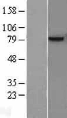 Western Blot: Osteoactivin/GPNMB Overexpression Lysate [NBL1-11239]