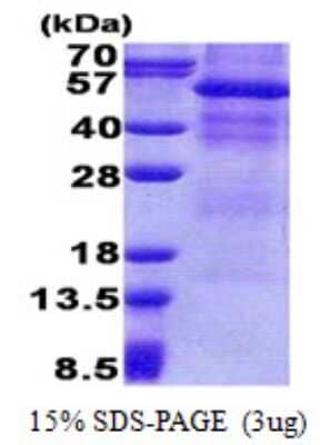 SDS-PAGE: Recombinant Human Osteoactivin/GPNMB His Protein [NBP2-23082]