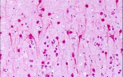 Immunohistochemistry-Paraffin: GPR1 Antibody - BSA Free [NLS74]
