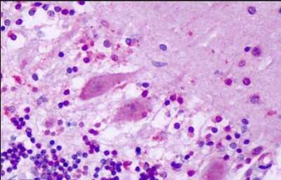 Immunohistochemistry-Paraffin: GPR1 Antibody - BSA Free [NLS74]