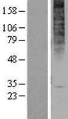 Western Blot: GPR1 Overexpression Lysate [NBP2-10925]