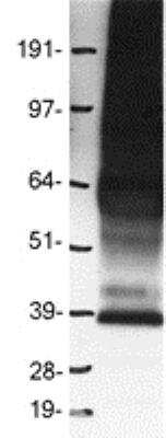 Western Blot: GPR10 Overexpression Lysate [NBP2-10573]