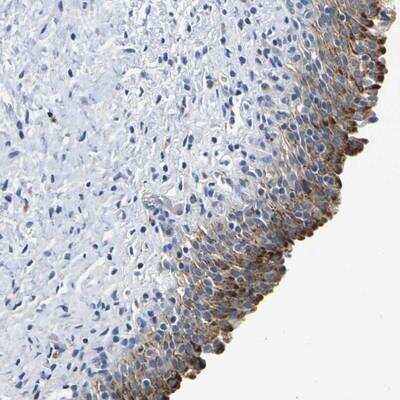 Immunohistochemistry: GPR103 Antibody [NBP1-89740]