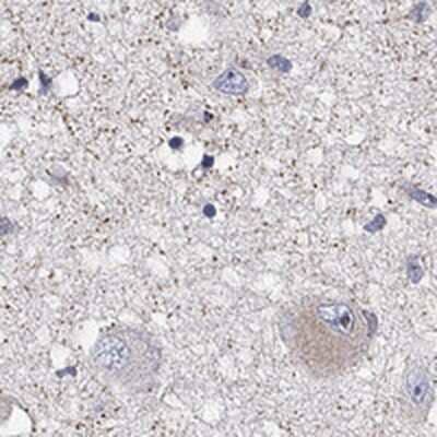 Immunohistochemistry-Paraffin: GPR103 Antibody [NBP3-17376]