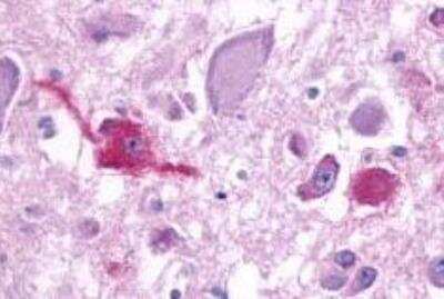 Immunohistochemistry-Paraffin: GPR103 Antibody - BSA Free [NLS1922]