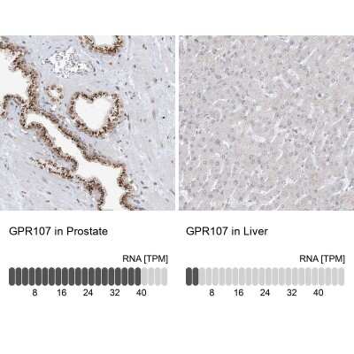 Immunohistochemistry-Paraffin: GPR107 Antibody [NBP1-83629]