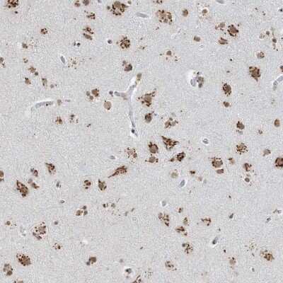 Immunohistochemistry-Paraffin: GPR107 Antibody [NBP1-83629]