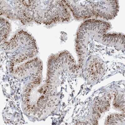 Immunohistochemistry-Paraffin: GPR107 Antibody [NBP1-83629]