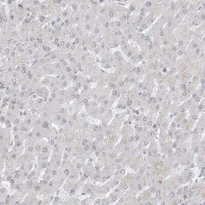 Immunohistochemistry-Paraffin: GPR107 Antibody [NBP1-83629]