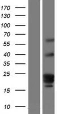 Western Blot: GPR107 Overexpression Lysate [NBP2-06585]