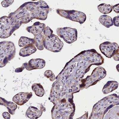 Immunohistochemistry: GPR108 Antibody [NBP1-82811]