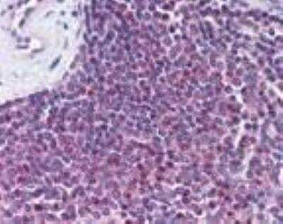 Immunohistochemistry: GPR109B/HM74 Antibody [NBP2-24488]