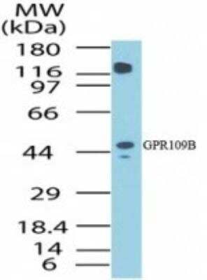 Western Blot: GPR109B/HM74 Antibody [NBP2-24488]