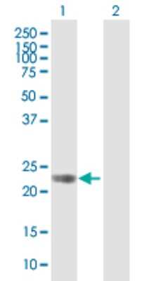 Western Blot: GPR110 Antibody [H00266977-B01P]