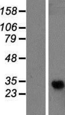 Western Blot: GPR110 Overexpression Lysate [NBP2-06246]