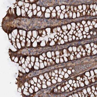 Immunohistochemistry-Paraffin: GPR112 Antibody [NBP1-80918]