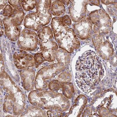 Immunohistochemistry-Paraffin: GPR113 Antibody [NBP1-83262]