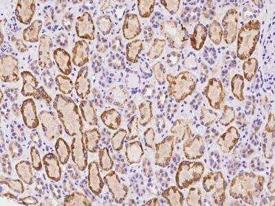 Immunohistochemistry-Paraffin: GPR113 Antibody [NBP3-06237]