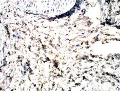 Immunohistochemistry-Paraffin: GPR113 Antibody [NBP3-12312]