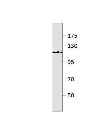 Western Blot: GPR113 Antibody [NBP3-12312]