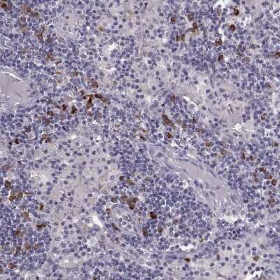 Immunohistochemistry-Paraffin: GPR114 Antibody [NBP1-87285]