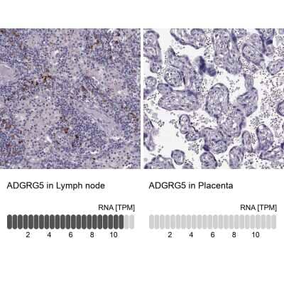 Immunohistochemistry-Paraffin: GPR114 Antibody [NBP1-87285]