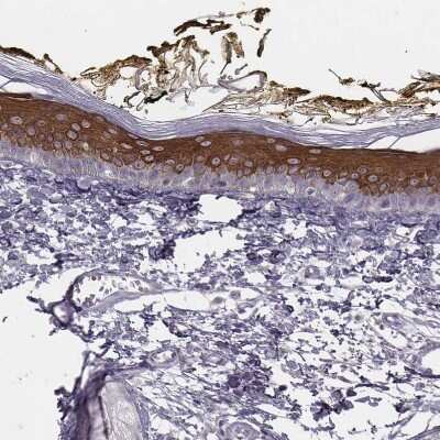 Immunohistochemistry-Paraffin: GPR115 Antibody [NBP2-58896]