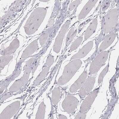 Immunohistochemistry-Paraffin: GPR115 Antibody [NBP2-58896]