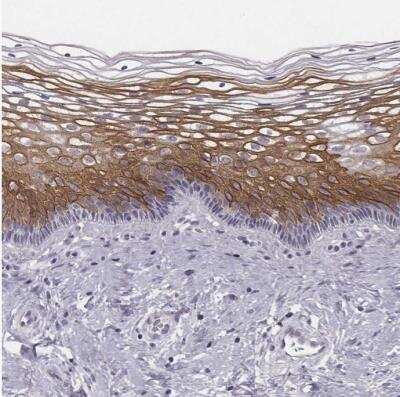 Immunohistochemistry-Paraffin: GPR115 Antibody [NBP2-58896]