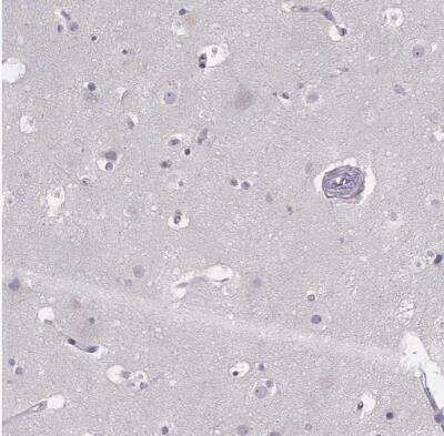 Immunohistochemistry-Paraffin: GPR115 Antibody [NBP2-58896]