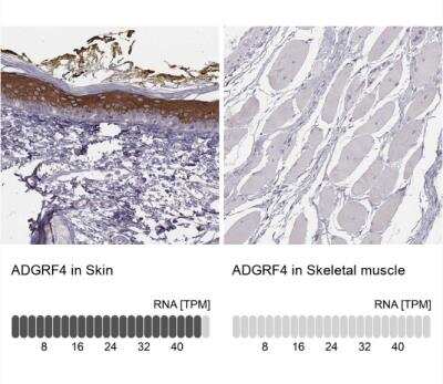 Immunohistochemistry-Paraffin: GPR115 Antibody [NBP2-58896]