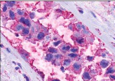 Immunohistochemistry-Paraffin: GPR116 Antibody - BSA Free [NLS1519]