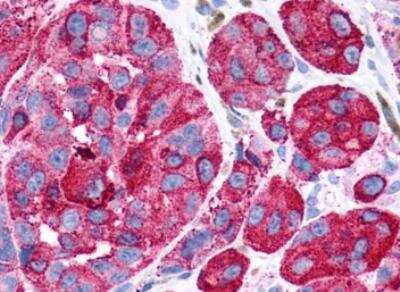 Immunohistochemistry-Paraffin: GPR116 Antibody - BSA Free [NLS1519]