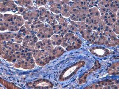 Immunohistochemistry: GPR119 Antibody - BSA Free [NLS548]