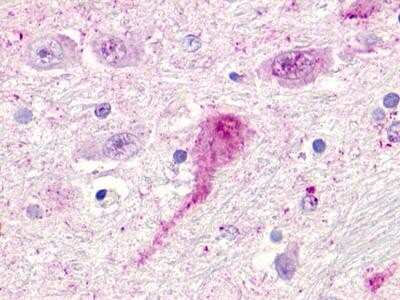 Immunohistochemistry: GPR119 Antibody - BSA Free [NLS548]