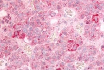 Immunohistochemistry-Paraffin: GPR12 Antibody [NBP3-14347]