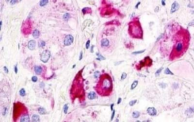 Immunohistochemistry-Paraffin: GPR12 Antibody [NBP3-14346]