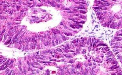 Immunohistochemistry-Paraffin: GPR12 Antibody - BSA Free [NLS78]