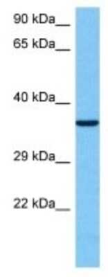 Western Blot: GPR12 Antibody [NBP3-10076]