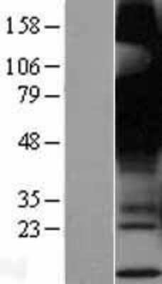 Western Blot: GPR12 Overexpression Lysate [NBP2-04285]