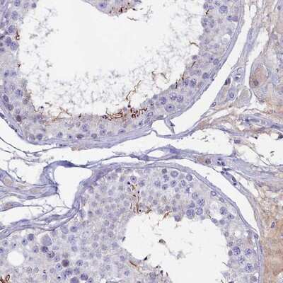 Immunohistochemistry-Paraffin: GPR123 Antibody [NBP1-82890]