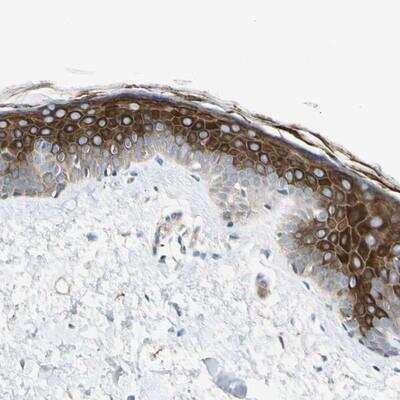 Immunohistochemistry-Paraffin: GPR125 Antibody [NBP1-89828]