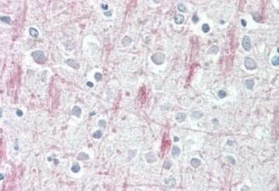 Immunohistochemistry-Paraffin: GPR125 Antibody [NBP1-03561]