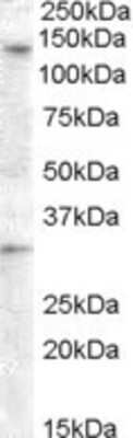 Western Blot: GPR125 Antibody [NBP1-03561]