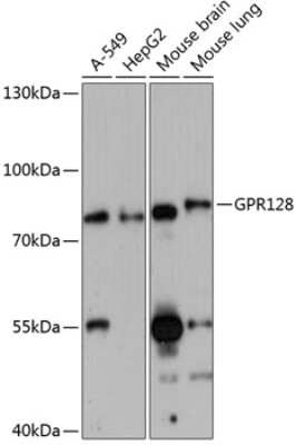 Western Blot: GPR128 AntibodyAzide and BSA Free [NBP3-04912]