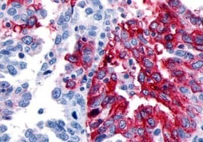 Immunohistochemistry-Paraffin: GPR133 Antibody [NBP3-14348]