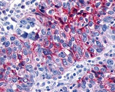 Immunohistochemistry-Paraffin: GPR133 Antibody - BSA Free [NLS2034]