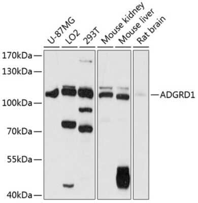 Western Blot: GPR133 AntibodyAzide and BSA Free [NBP3-03815]