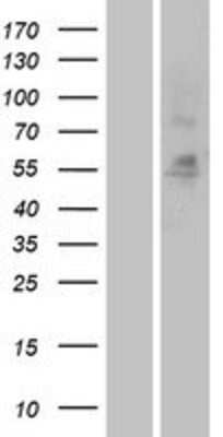 Western Blot: GPR133 Overexpression Lysate [NBP2-04451]