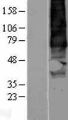 Western Blot: GPR137B Overexpression Lysate [NBP2-04246]